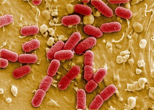 Cepa de bacterias Escherichia coli. (Crédito: AFP).