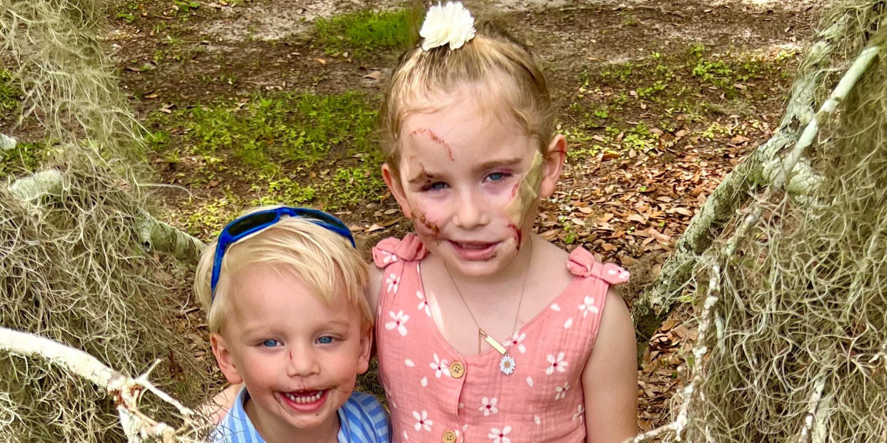 The two children are recovering after the bites.  (Courtesy of Bethany Hastings)