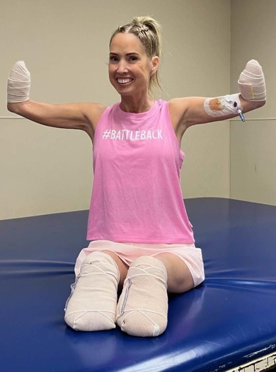 Teacher loses arms and legs to sepsis (Courtesy Sherri Moody)