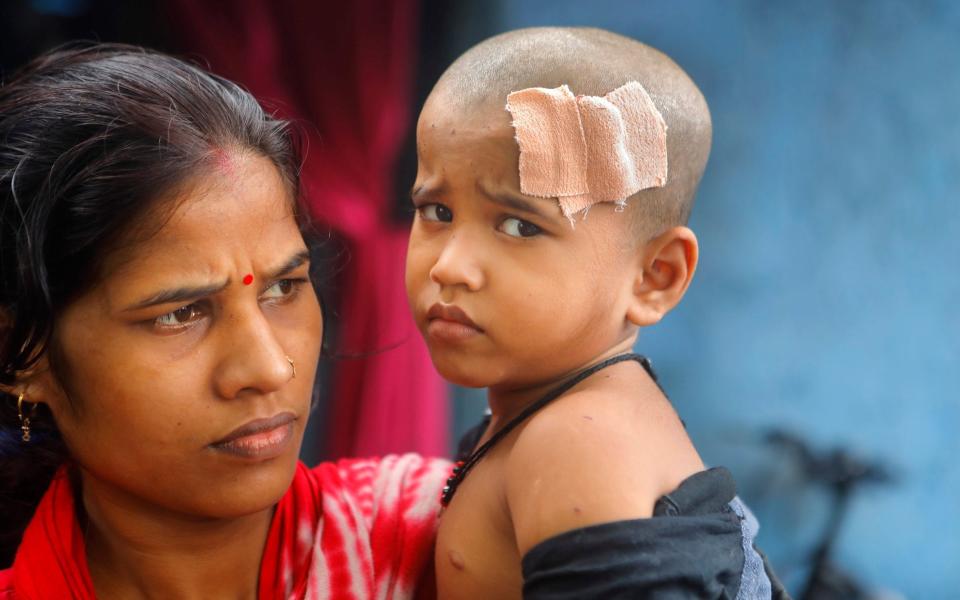 Four year old Ayush Yadav was pounced on outside his home - Subhash Sharma for The Daily Telegraph