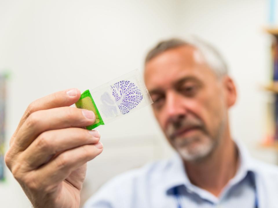 Researcher at the brain bank in London