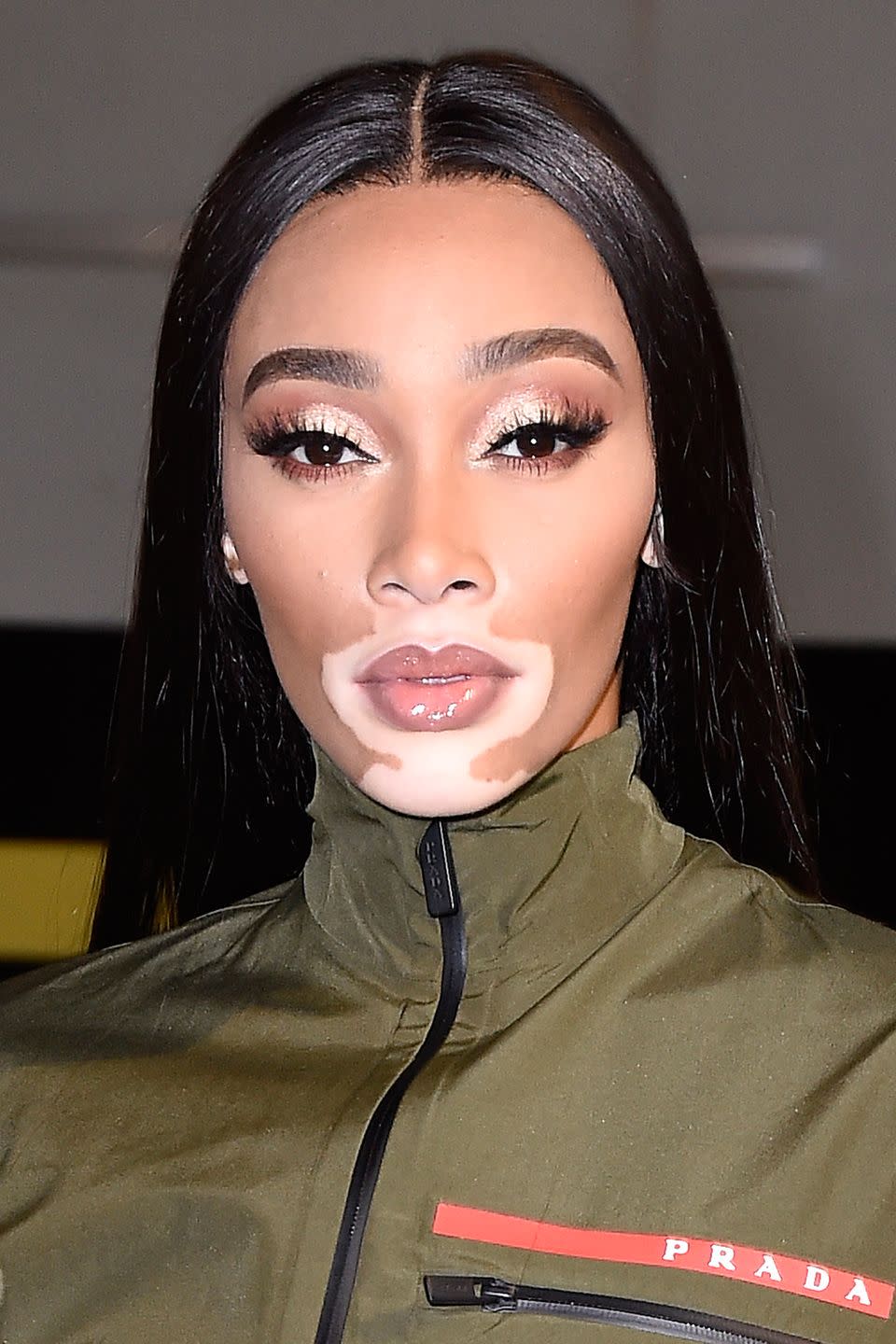 Winnie Harlow