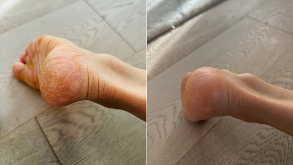 Before and after using the Hippie Stick Everywhere Balm (Photos via Sarah DiMuro).