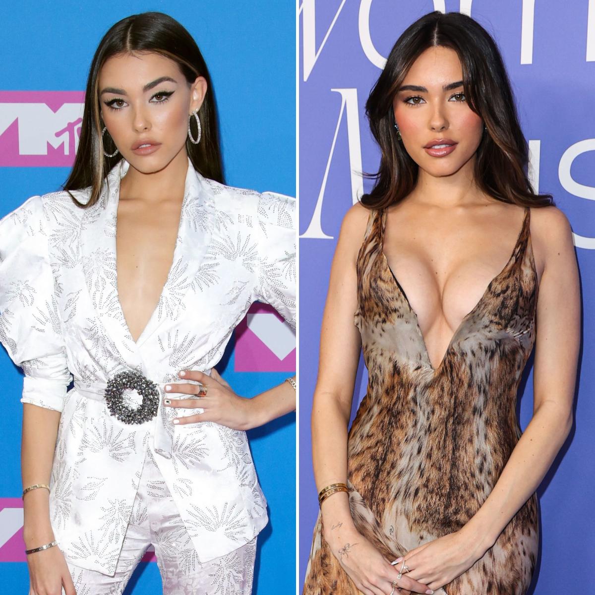 Madison Beer Has Addressed Plastic Surgery Rumors Over the Years: See  Before, After Photos