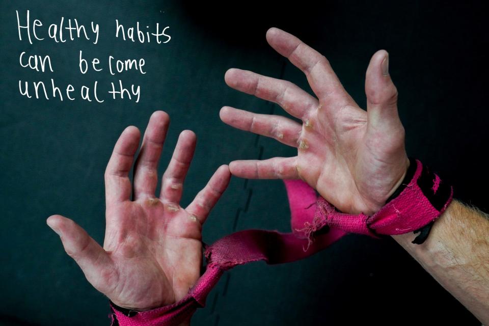 Tommy Hojnicki, 23, of East Lansing, shows his calluses from lifting at Michigan State University's IM West recreational facility in East Lansing on Thursday, Aug. 17, 2023. Hojnicki joined his local gym in sixth grade, after finding out his father's stroke could have been prevented with exercise. Now, going to the gym six times a week, Hojnicki said it's difficult to maintain positive self-image. "It's always, 'I look good today,' rather than 'I look good in general,' " Hojnicki said when talking about his self-talk. "There's always critiquing."