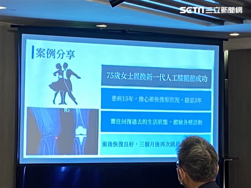 一名75歲婦人喜歡跳國標舞、15年前罹患膝關節炎，醫師建議需置換人工膝關節，但她擔心術後復原狀況慢而隱忍多時。（圖／記者簡浩正攝影）