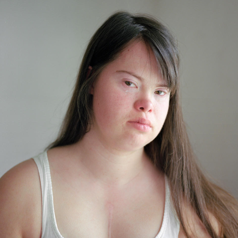 For years, a photographer took photos of a young woman with Down syndrome, helping teach her what we too rarely see about those with the disorder