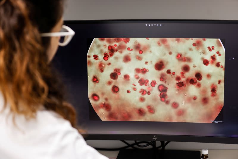 A worker inspects magnified species cells on a screen at the offices of Steakholder Foods in Rehovot