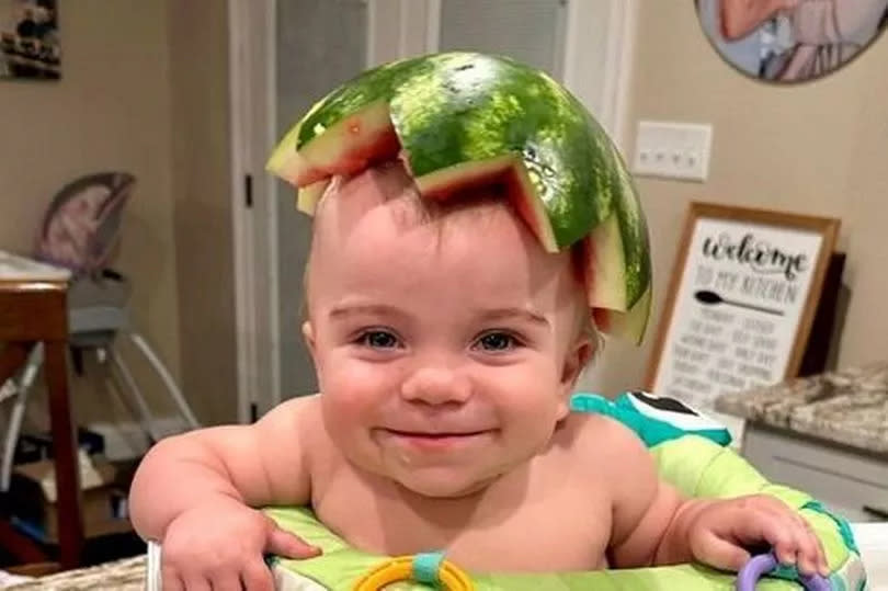 Baby Lydia with sliced watermelon on head smiling