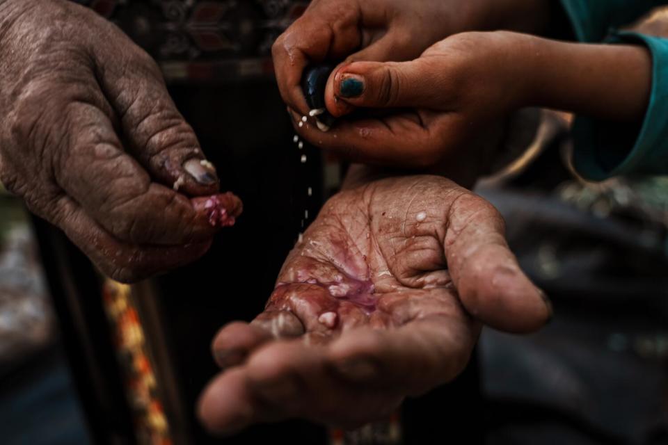 A closeup of four hands, the smaller two squeezing an olive as a larger, wrinkled palm catches its juice