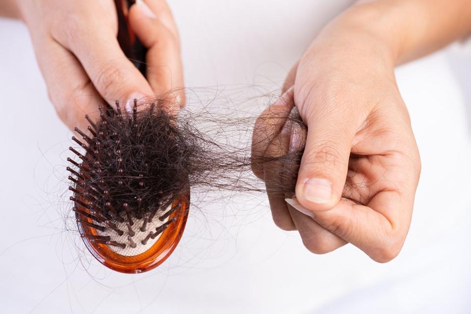 8) Hair Loss Can Be Treated Internally and Topically