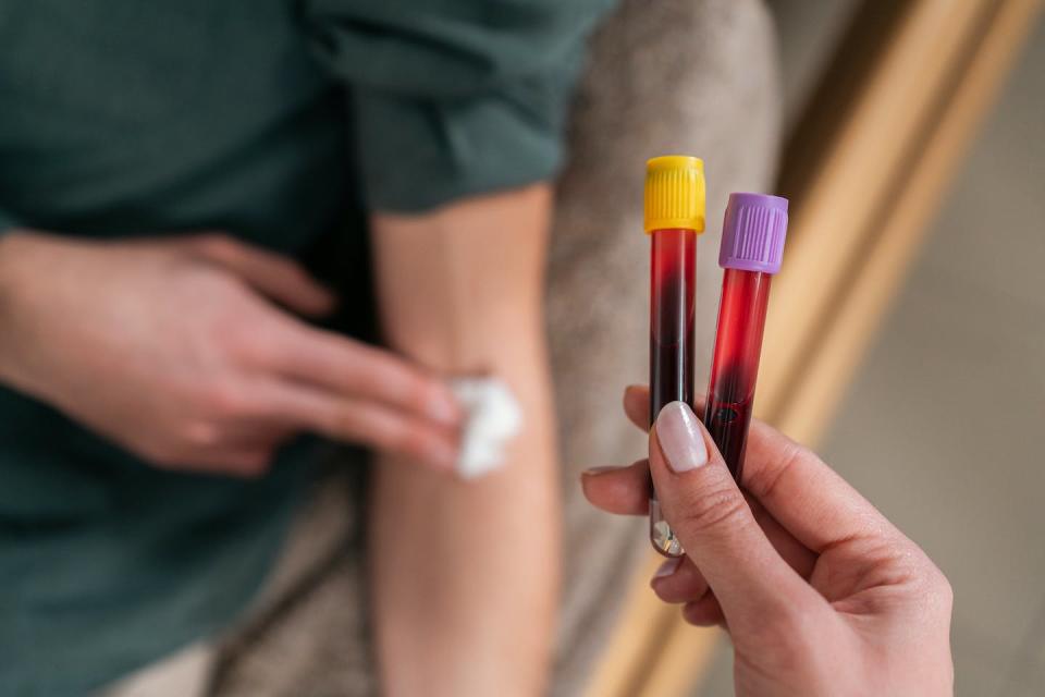 Close-up of a person holding gauze against the crook of their arm while another person holds up two heparin tubes of blood