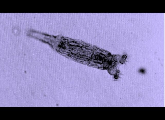 Rotifers swing both ways, with the ability to reproduce sexually or asexually.    <em>Flickr photo by <a href="http://www.flickr.com/photos/22616984@N07/" target="_hplink">Ian Sutton</a> </em>