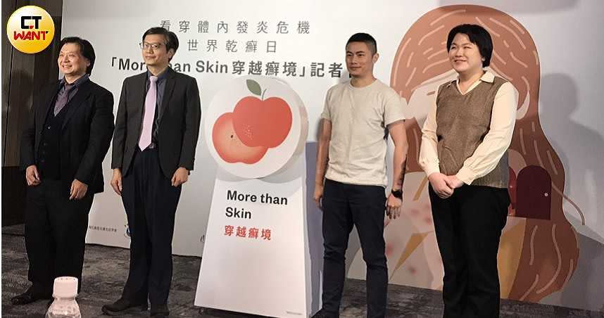 台灣乾癬暨皮膚免疫學會與台灣乾癬病友協會共推「More than Skin」活動，也首次邀請設計師聶永真進行聯名的視覺設計。（圖／張雅淳攝）