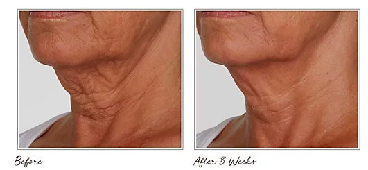 The before and after photos are impressive! (Photo: QVC)