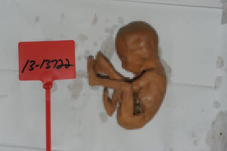 EDITOR’S NOTE: Reuters has pixelated this image; editors judged the original image to be disturbingly graphic. In a photograph obtained by Reuters, a fetus lies alongside a government evidence marker. The fetus and three others were found during a 2013 search of a Detroit warehouse operated by Arthur Rathburn, a businessman who sold human body parts for medical research and education. Rathburn has pleaded not guilty to selling infected body parts of adults. Government photo via REUTERS