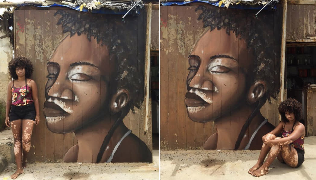 Brazilian muralist draws inspiration for his latest mural from a local teen with vitiligo. (Photo: <a href="http://alexandreketo.com/" rel="nofollow noopener" target="_blank" data-ylk="slk:Alexandre Keto;elm:context_link;itc:0;sec:content-canvas" class="link ">Alexandre Keto</a>)