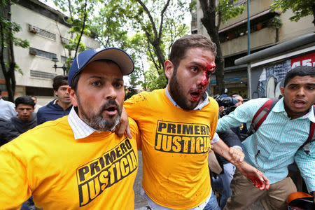 Juan Requesens (C), deputy of the Venezuelan coalition of opposition parties (MUD), is helped after been injured during clashes with pro-government supporters outside the offices of the Venezuela's ombudsman in Caracas, Venezuela April 3, 2017. REUTERS/Carlos Garcia Rawlins