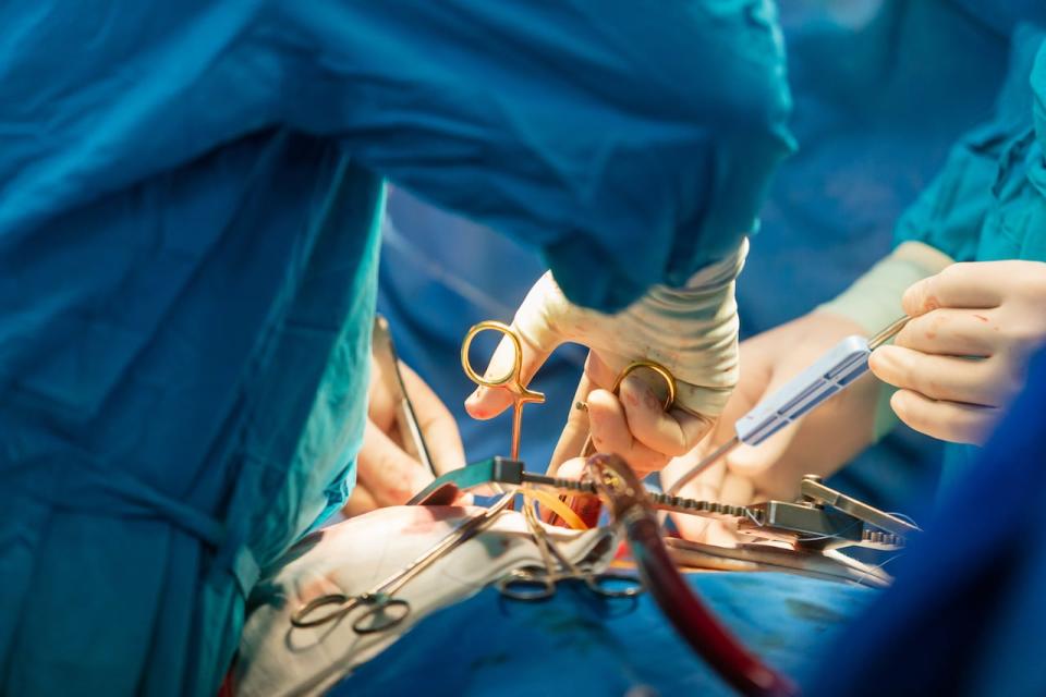 Open heart surgery is performed by surgeons. During these procedures the heart and lungs are bypassed using a cardiopulmonary bypass.  Oxygenators are a key component of the machines, putting oxygen back into the blood. (Shutterstock - image credit)