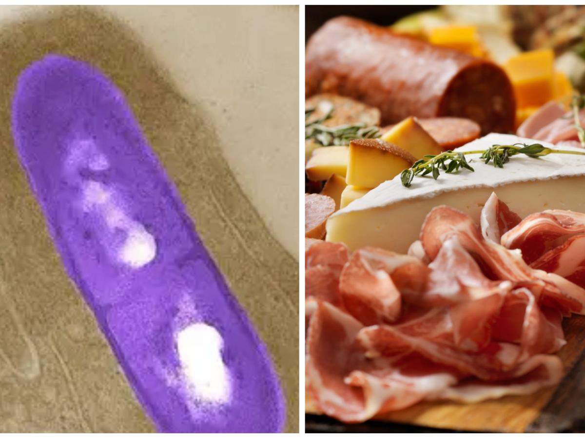 Deli meat and cheese has been linked to a listeria outbreak in six