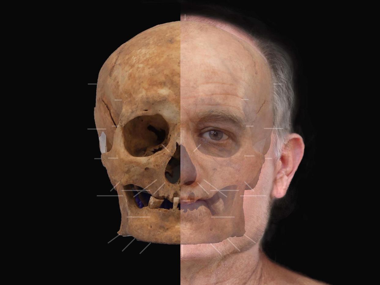 An artist's impression of a medieval skull after experts reconstructed the face of the man whose 600-year-old skeleton was unearthed during excavation work at the redevelopment of Aberdeen Art Gallery in 2015: PA