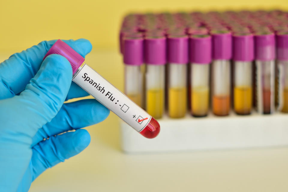 Blood sample positive with Spanish Flu virus