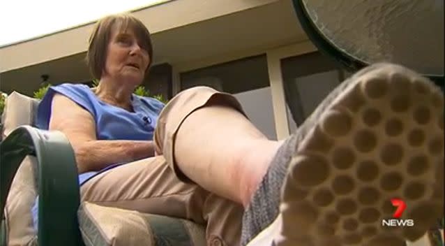 Barbara McDougall was bitten on the leg while taking out her rubbish. Photo: 7 News