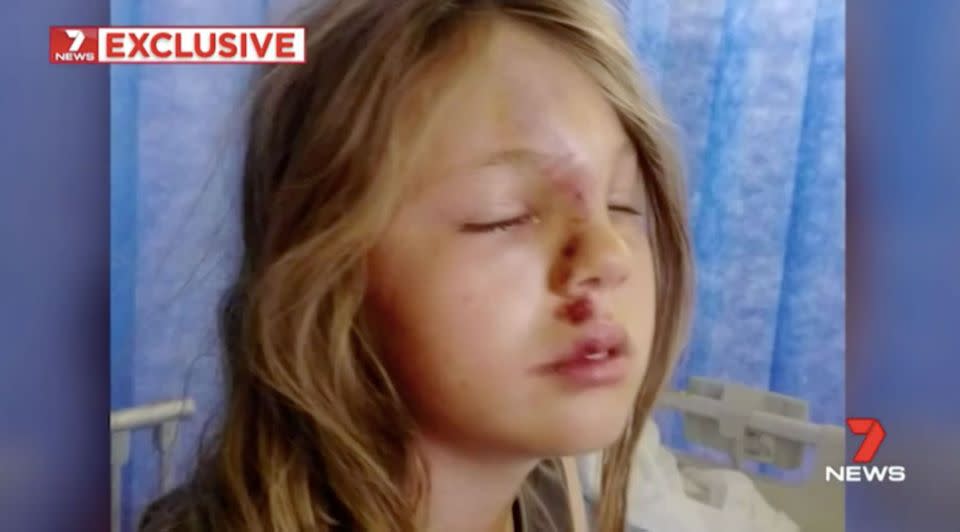 Alannah Davey was found bleeding and unconscious outside her home. Source: 7 News