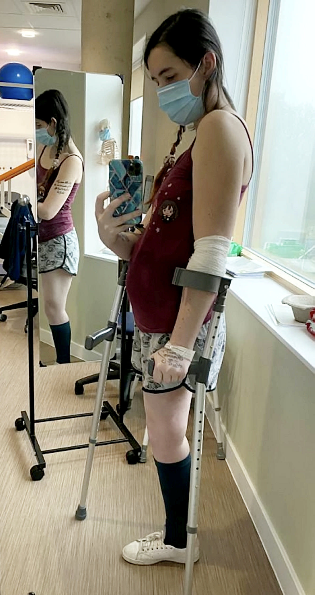 Osborne spent the rest of her pregnancy adjusting to life after having her leg amputated. (SWNS)