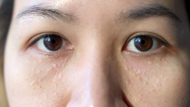 Why Does Your Face Turn Pale When You're Scared? » Science ABC