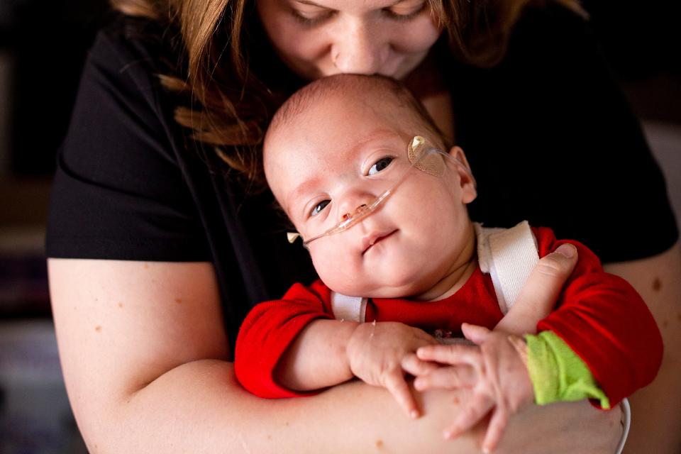 Katarina Torrez kisses her baby Emilio on the head on Thursday, Jan. 11, 2024, at their home. Emilio was diagnosed with spina bifida during Katarinals 2nd trimester, and they were first people to undergo fetoscopic MMC spina bifida repair at Children's Hospital Colorado.