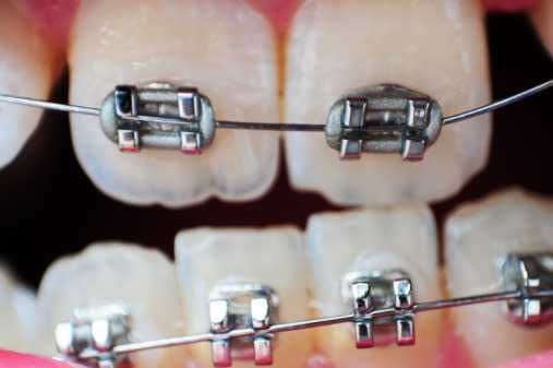 La nicotina puede aflojar los dientes durante el tratamiento / Foto: Thinkstock