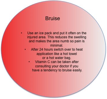 First Aid Tips: What to do in case of a bruise