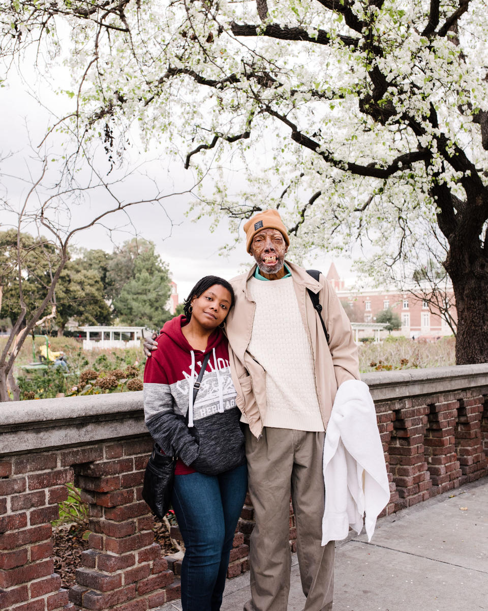 Chelsea with his daughter Ebony at home in California in February 2019, months before his transplant surgery | John Francis Peters for TIME