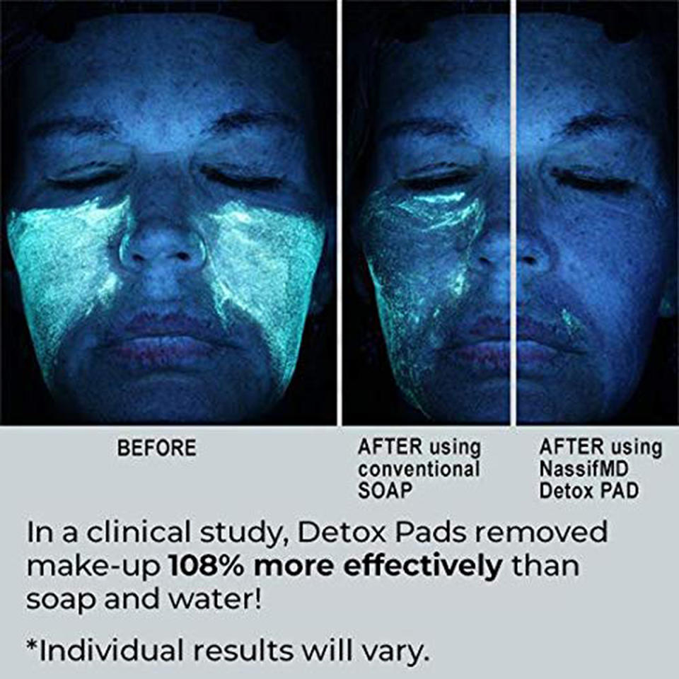 amazon-nassifmd-detox-pads