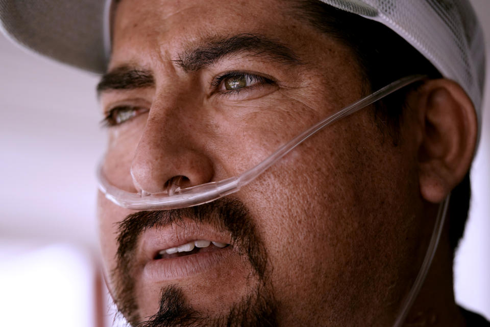 Freddy Fernandez looks out from the porch of his home after taking a short walk Friday, June 10, 2022, in Carthage, Mo. After contracting COVID-19 in August 2021, Fernandez spent months hooked up to a respirator and an ECMO machine before coming home in February 2022 to begin his long recovery from the disease. (AP Photo/Charlie Riedel)