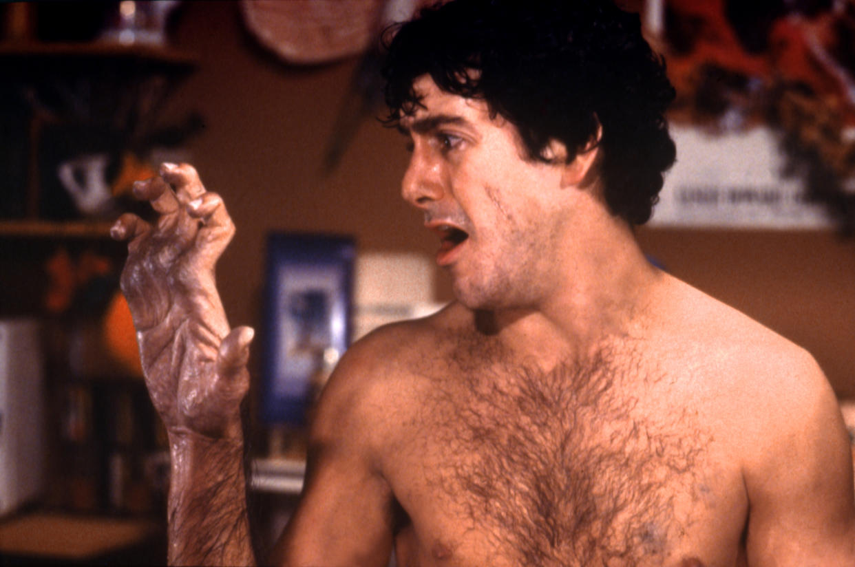 American actor David Naughton on the set of An American Werewolf in London, written and directed by John Landis. (Photo by Universal Pictures/Sunset Boulevard/Corbis via Getty Images)