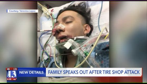 Police say Alan Dale Covington bashed&nbsp;Luis Gustavo Lopez's face with a metal bar after shouting that he hated Mexicans. (Photo: Fox 31)