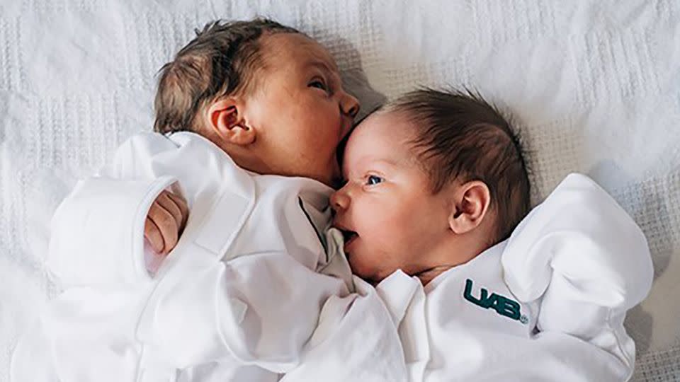 Roxi, left, was born December 19 at 7:45 p.m., weighing 7 pounds 7 ounces, and Rebel, right, was born December 20 at 6:10 a.m., weighing 7 pounds 3.5 ounces. - Andrea Mabry/University of Alabama at Birmingham Hospital