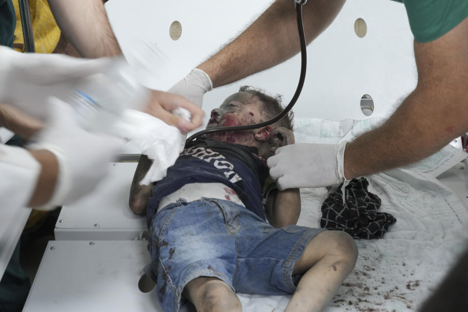Palestinian child wounded in Israeli bombardment is treated in a hospital in Deir al Balah, south of the Gaza Strip, Friday, Oct.27, 2023. ( AP Photo/Hatem Moussa)