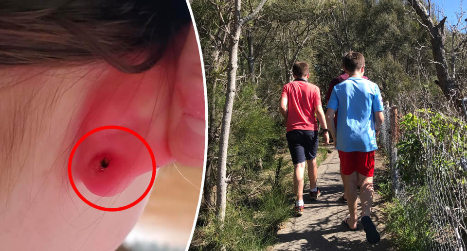 A tick embedded in the child's earlobe sparked a warning to other parents. Source: Facebook