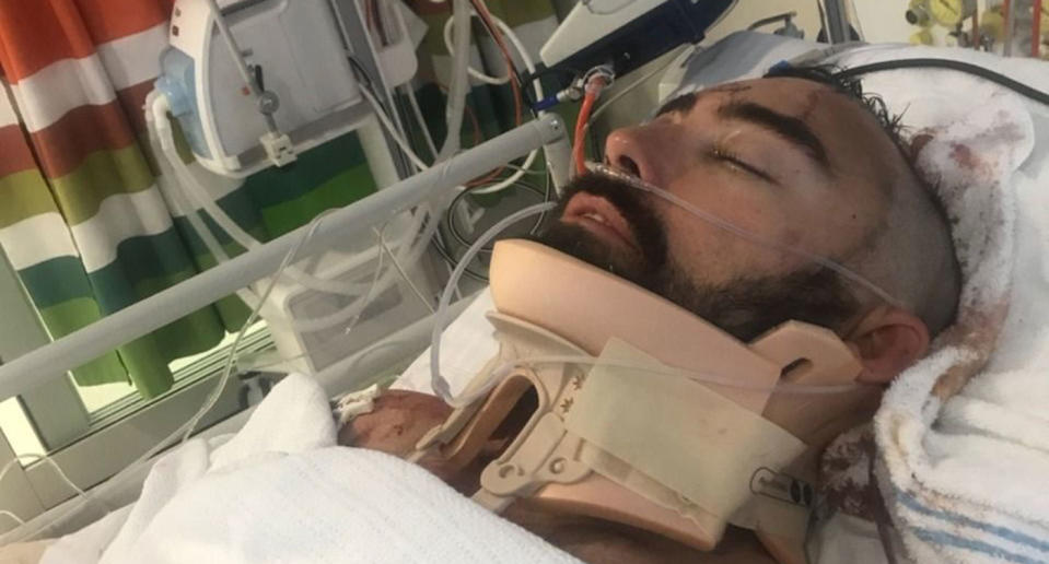 Sydney father Brad Lewis has suffered serious injuries after he plunged from a four-metre balcony trying to stop his son Oscar from falling. Source: GoFundMe/ Hero Dad Hurt Saving Son