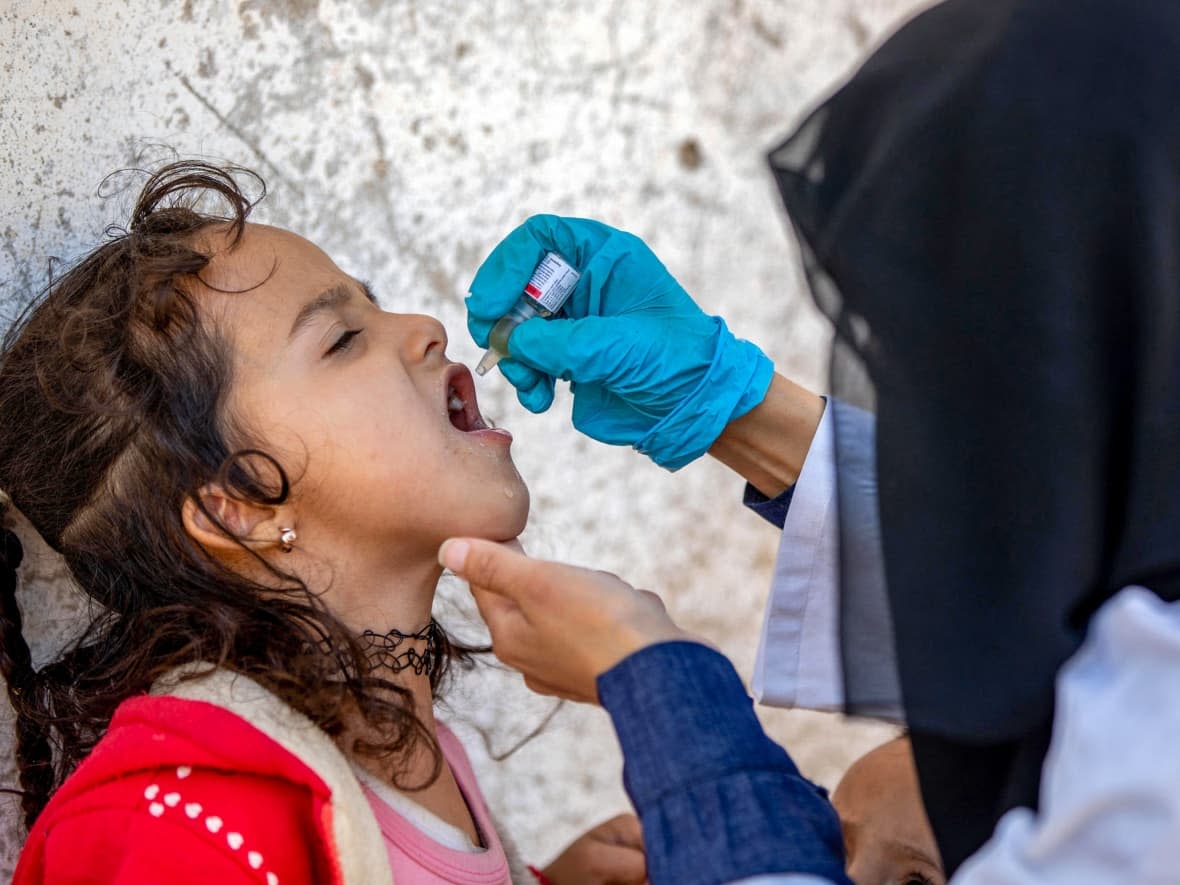 A Yemeni child receives an oral polio vaccination during a home visit by health workers as part of an immunization campaign in February 2022. (Ahmad Al-Basha/AFP/Getty Images - image credit)