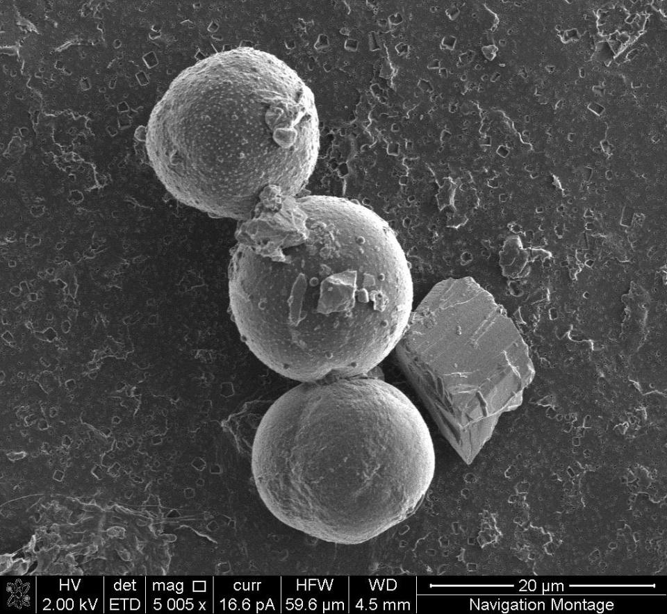 algae cells three round balls in black and white microscope image