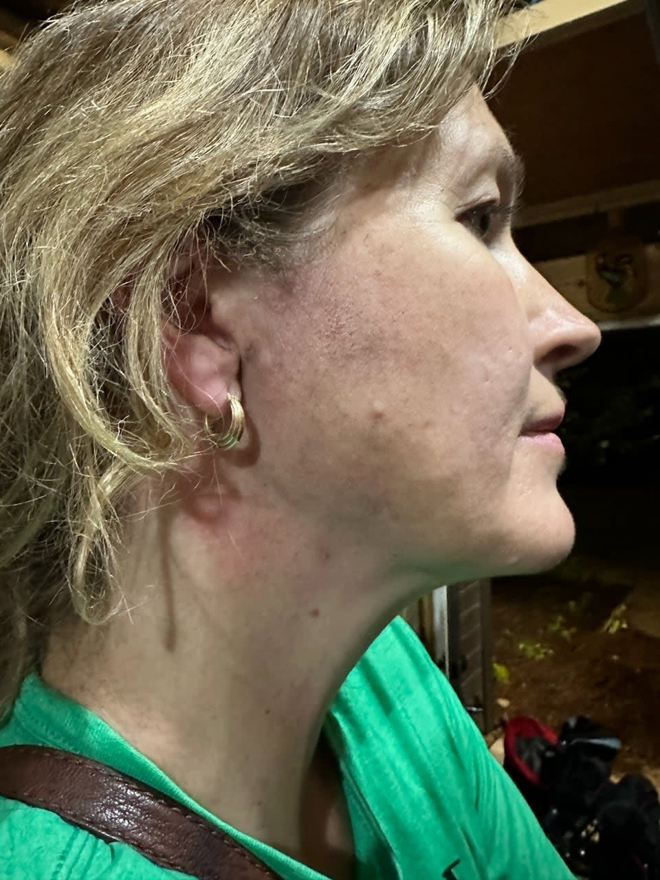 Ward 7 Waterloo Coun. Julie Wright said she didn't have any significant injuries, but her hair was singed after a man shot a firework at her on Canada Day. 