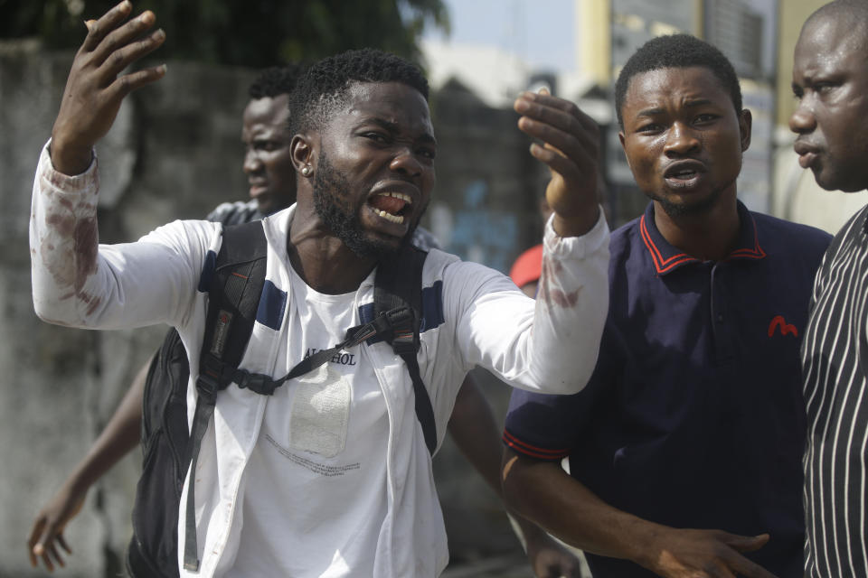 Alister, a protester who says his brother Emeka died from a stray bullet from the Army, reacts while speaking to Associated Press near Lekki toll gate in Lagos, Nigeria, Tuesday Oct. 20, 2020. After 13 days of protests against alleged police brutality, authorities have imposed a 24-hour curfew in Lagos, Nigeria's largest city, as moves are made to stop growing violence. ( AP Photo/Sunday Alamba)