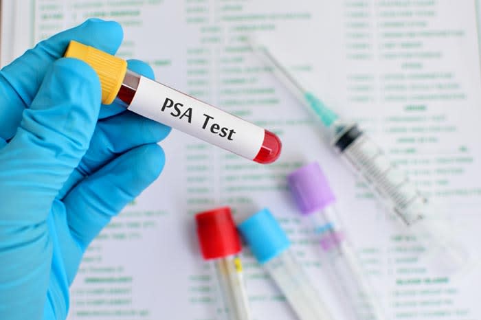 analisis de PSA