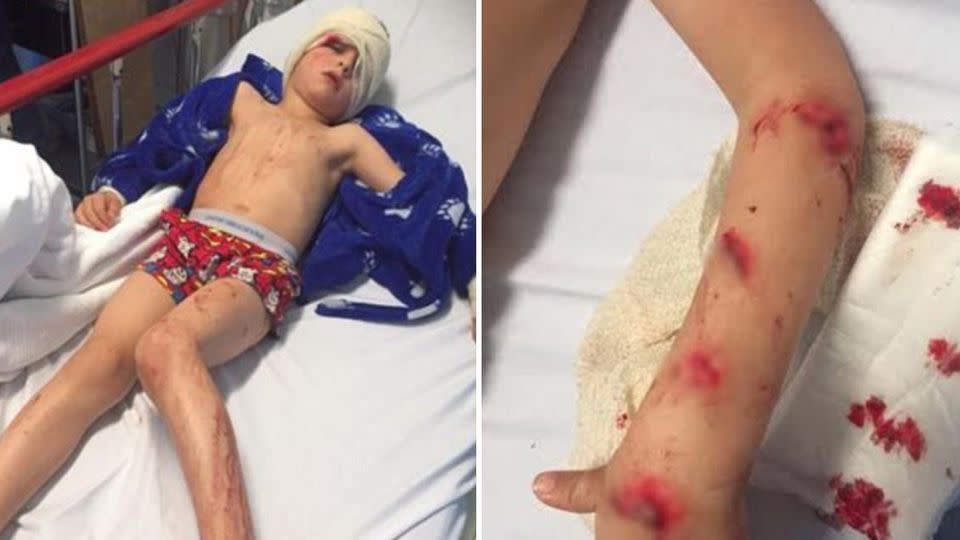 Cruz suffered lacerations to both arms, his head and his chest, muscle damage in his arm. Source: Supplied