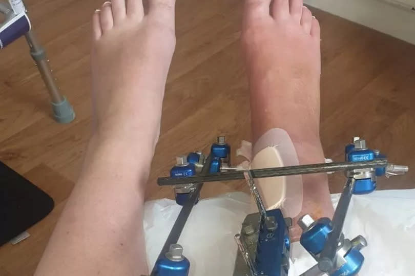 Τραυματισμός στο πόδι του Eden Garrity