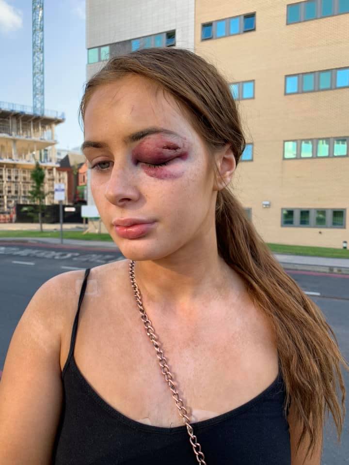 Gabrielle Walsh, 18, was were violently attacked by a man in Manchester. Source: Facebook